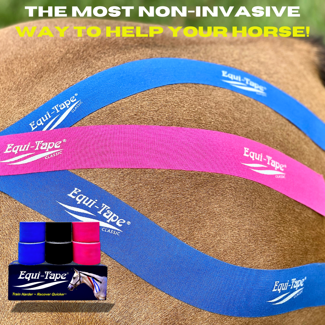 Advantage 2" Color Pack 2 Rolls Each (Black-Pink-Royal Blue)